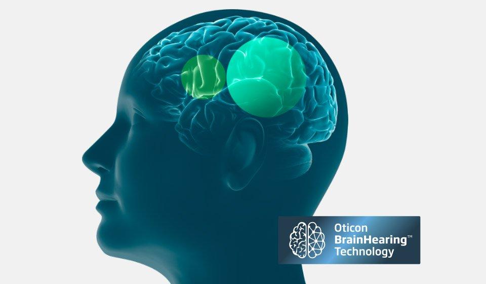 ¿Qué es BRAIN HEARING?